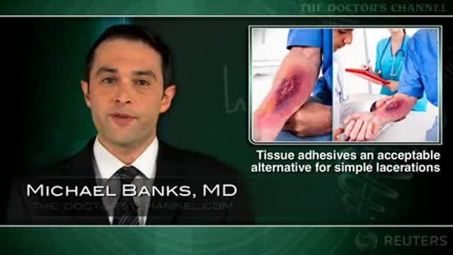 Tissue adhesives an acceptable alternative for simple lacerations Thumbnail