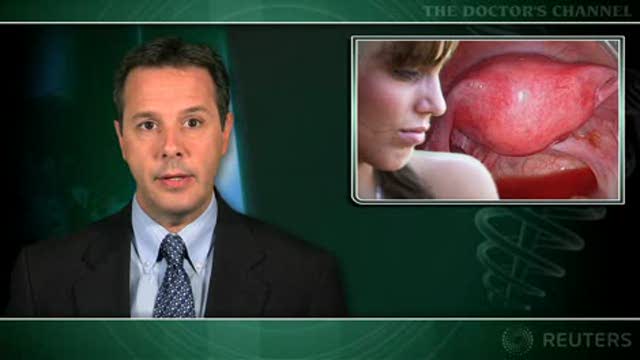Endometrial ablation has advantages over hysterectomy for heavy menstruation Thumbnail