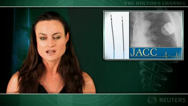 Recalled ICD leads have little impact on mortality Thumbnail