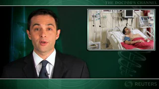 Pulmonary disorders increased in AF patients taking amiodarone Thumbnail