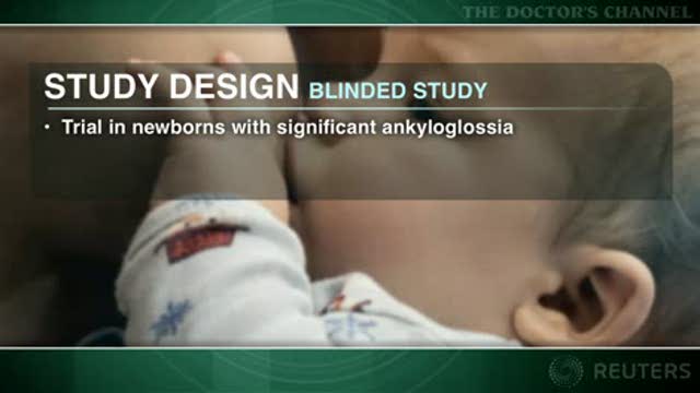 Release of tongue-tie in neonates immediately improves breastfeeding Thumbnail