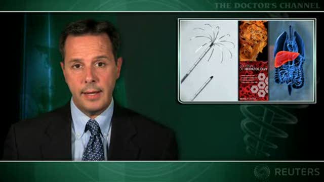 RF ablation alternative to surgery in early liver cancer Thumbnail