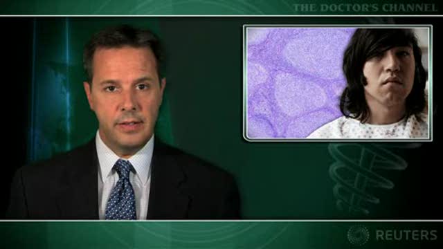 Bortezomib of uncertain benefit in therapy for follicular lymphoma Thumbnail