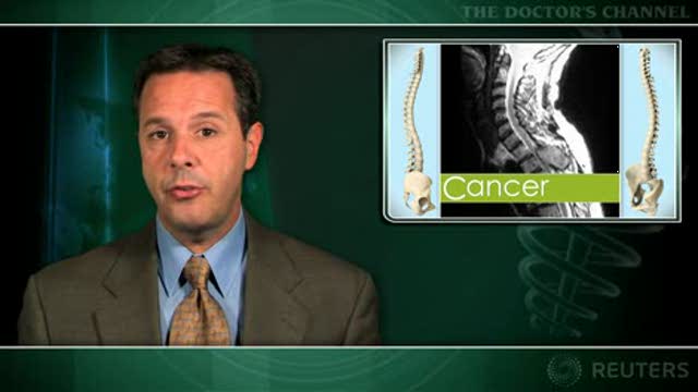 Worse outcomes after spinal metastases surgery at academic medical centers in July Thumbnail
