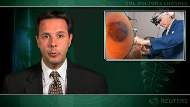 Choroidal melanomas near optic nerve treatable with proton irradiation Thumbnail