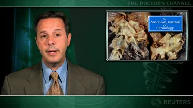 Combination therapy of little benefit in pulmonary hypertension Thumbnail