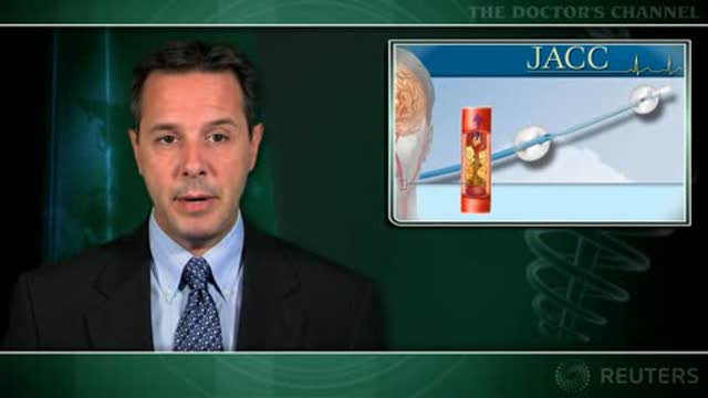 Proximal occlusion device reduces microemboli during carotid artery stenting Thumbnail