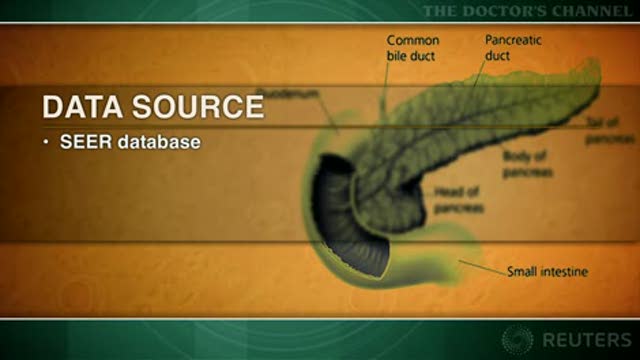 Pancreatic carcinoma risk increased after certain other primary cancers Thumbnail