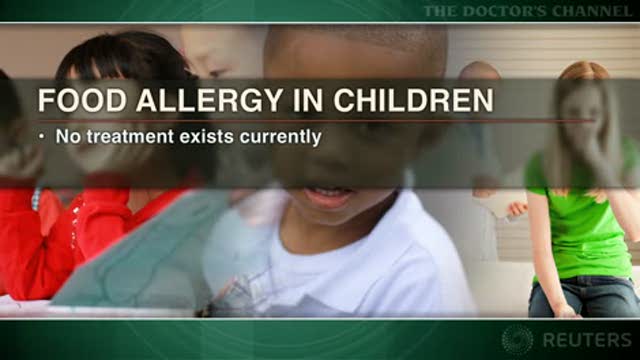 New report focuses on managing food allergy in children Thumbnail