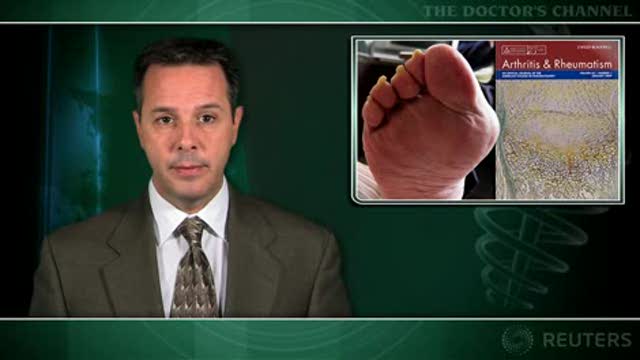 Diuretics increase gout risk by raising serum urate levels Thumbnail