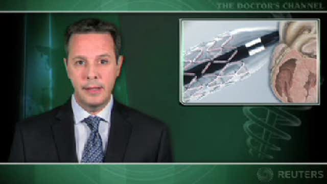 No long-term benefits seen with late PCI of infarct-related artery after MI Thumbnail