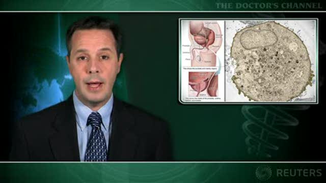 External radiation plus high-dose brachytherapy effective for high-risk prostate cancer Thumbnail