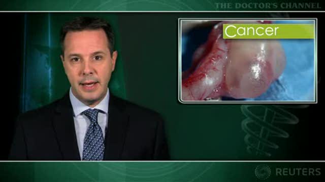 Combo treatment better than sequential but more toxic in recurrent ovarian cancer Thumbnail