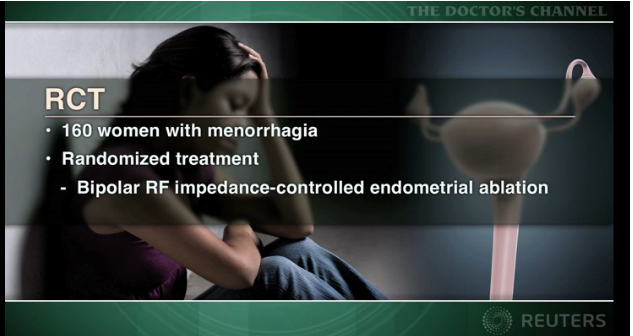Bipolar RF endometrial ablation beats hydrothermablation for menorrhagia Thumbnail