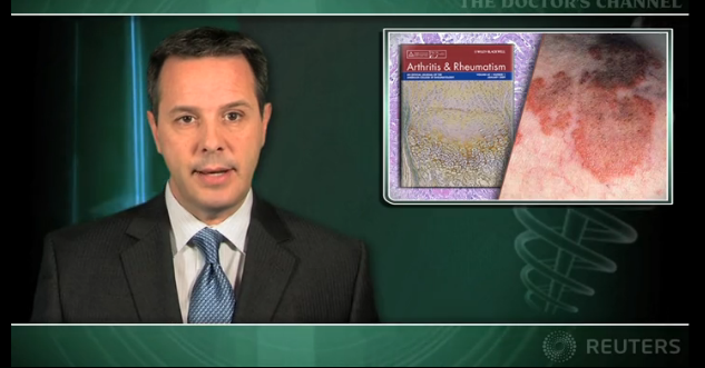 Severe cryoglobulinemic vasculitis responds to rituximab therapy Thumbnail