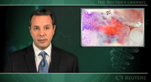 CIN 1 does not increase CIN 3 risk beyond HPV infection Thumbnail