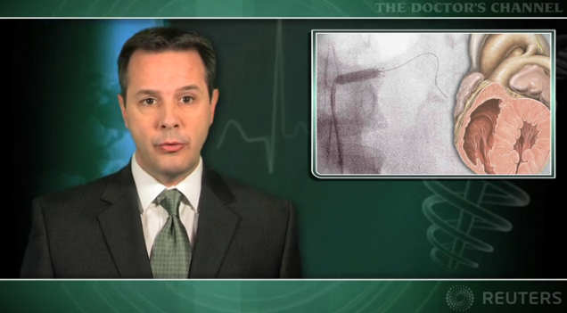 Sirolimus-eluting stent a good option for BMS and DES in-stent restenosis Thumbnail