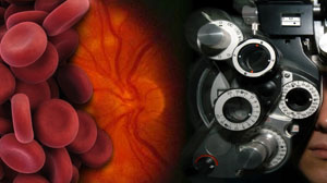 Longer screening interval for retinopathy might be safe for some diabetics Thumbnail