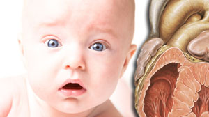 No apparent benefit to early medical therapy for patent ductus arteriosus: study Thumbnail