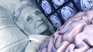 CT findings predict recurrent stroke after TIA or minor stroke Thumbnail