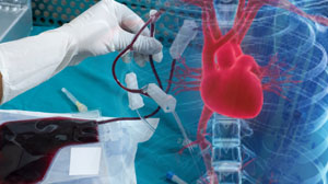 Cardiac function improves with stem cell therapy after MI Thumbnail