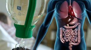 Noradrenaline a cost-effective option for type 1 hepatorenal syndrome Thumbnail