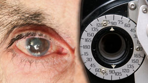 Postcataract surgery endophthalmitis rates declining in United States Thumbnail