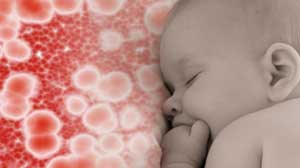Transfusions may increase risk of neonatal necrotizing enterocolitis Thumbnail