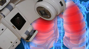 Stereotactic body radiotherapy effective for solitary pulmonary nodules Thumbnail