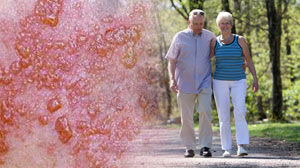 Investigational drug speeds healing of genital herpes lesions Thumbnail
