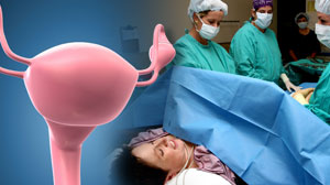 Recombinant luteinizing hormone improves IVF outcomes in older subjects Thumbnail
