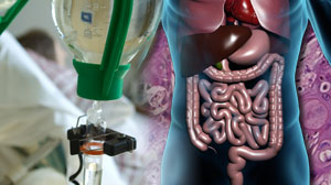 Salvage therapy improves survival in pretreated gastric cancer Thumbnail