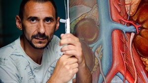 Antiplatelet therapy benefit doubtful in chronic kidney disease Thumbnail