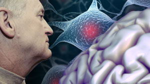 Darbepoietin improves outcomes of severe traumatic brain injury Thumbnail