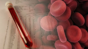 Once-daily lixisenatide effective as monotherapy for DM2 Thumbnail