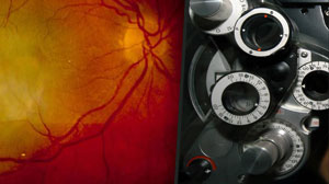 Verteporfin does not improve efficacy of ranibizumab for macular degeneration Thumbnail