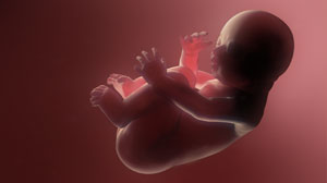 Sotalol effective first-line therapy for fetal supraventricular tachyarrhythmia Thumbnail
