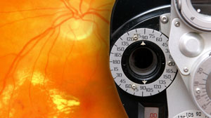 Bevacizumab efficacy in diabetic macular edema sustained at 2 years Thumbnail