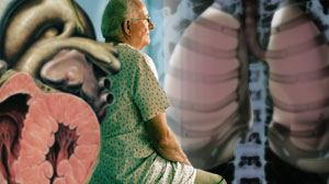 Adjuvant cetuximab improves some outcomes of high-risk rectal cancer Thumbnail