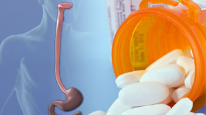 Doubled dose of rabeprazole increases cure rate of refractory esophagitis Thumbnail