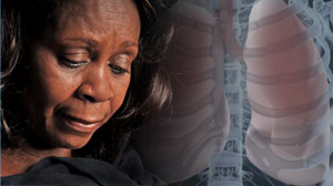 Cisplatin and carboplatin have similar efficacy in small-cell lung cancer Thumbnail