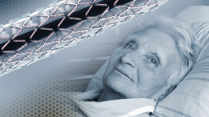 Add-on bevacizumab slows progression of recurrent ovarian cancer Thumbnail