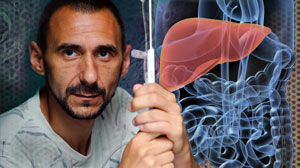 Adjuvant therapy beneficial in high-risk biliary tract tumors: meta-analysis Thumbnail