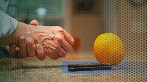 Step-up therapy favored for early rheumatoid arthritis Thumbnail