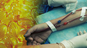 Mixed results on fish oil for keeping hemodialysis grafts clear Thumbnail