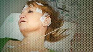 Perampanel reduces refractory partial-onset seizures Thumbnail