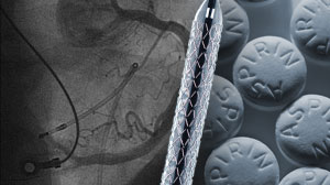 Pharmacodynamic study hints at optimal prasugrel reloading dose before PCI Thumbnail
