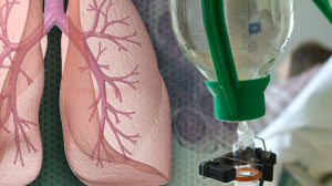 Single-agent maintenance improves survival in NSCLC Thumbnail