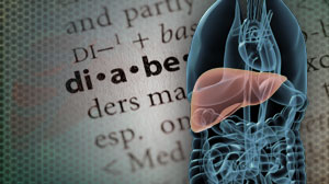 Metformin may prevent liver cancer in type 2 diabetes Thumbnail