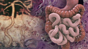 FDG-PET contributes to staging of localized gastric cancer Thumbnail